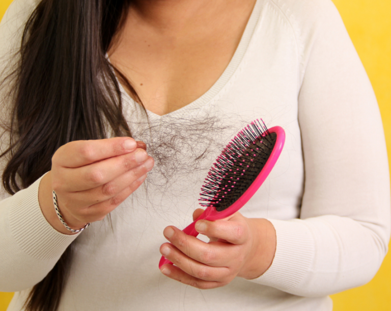 Hair Loss After Bariatric Surgery: Must-Know Facts & Tips
