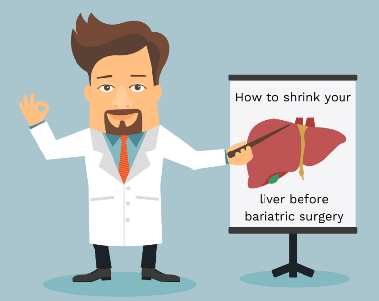 How to shrink your liver before bariatric surgery