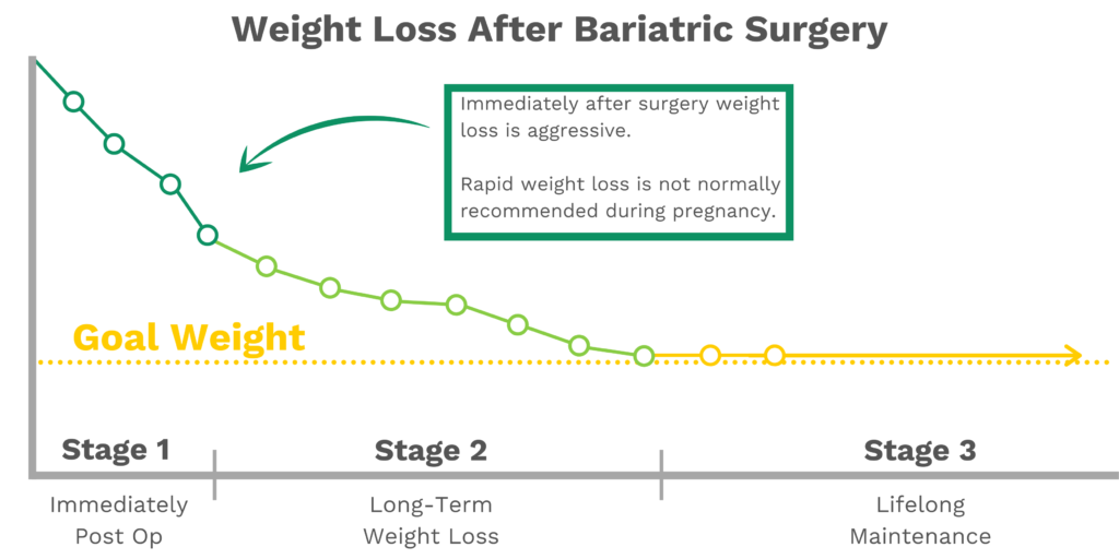 Getting Pregnant after Gastric Sleeve Surgery Bari Life