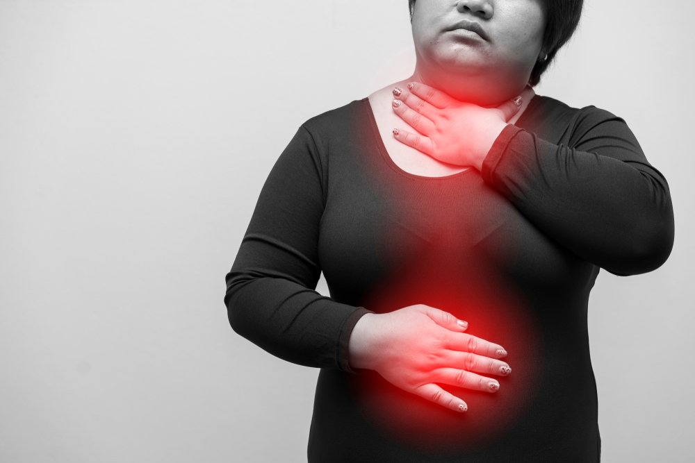 Hiatal Hernia after Gastric Bypass feature inline