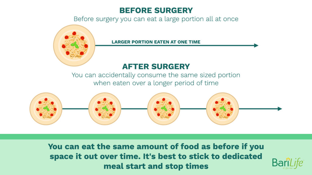 Eating smaller amounts of pasta after sleeve gastrectomy surgery over time can add up to one large serving