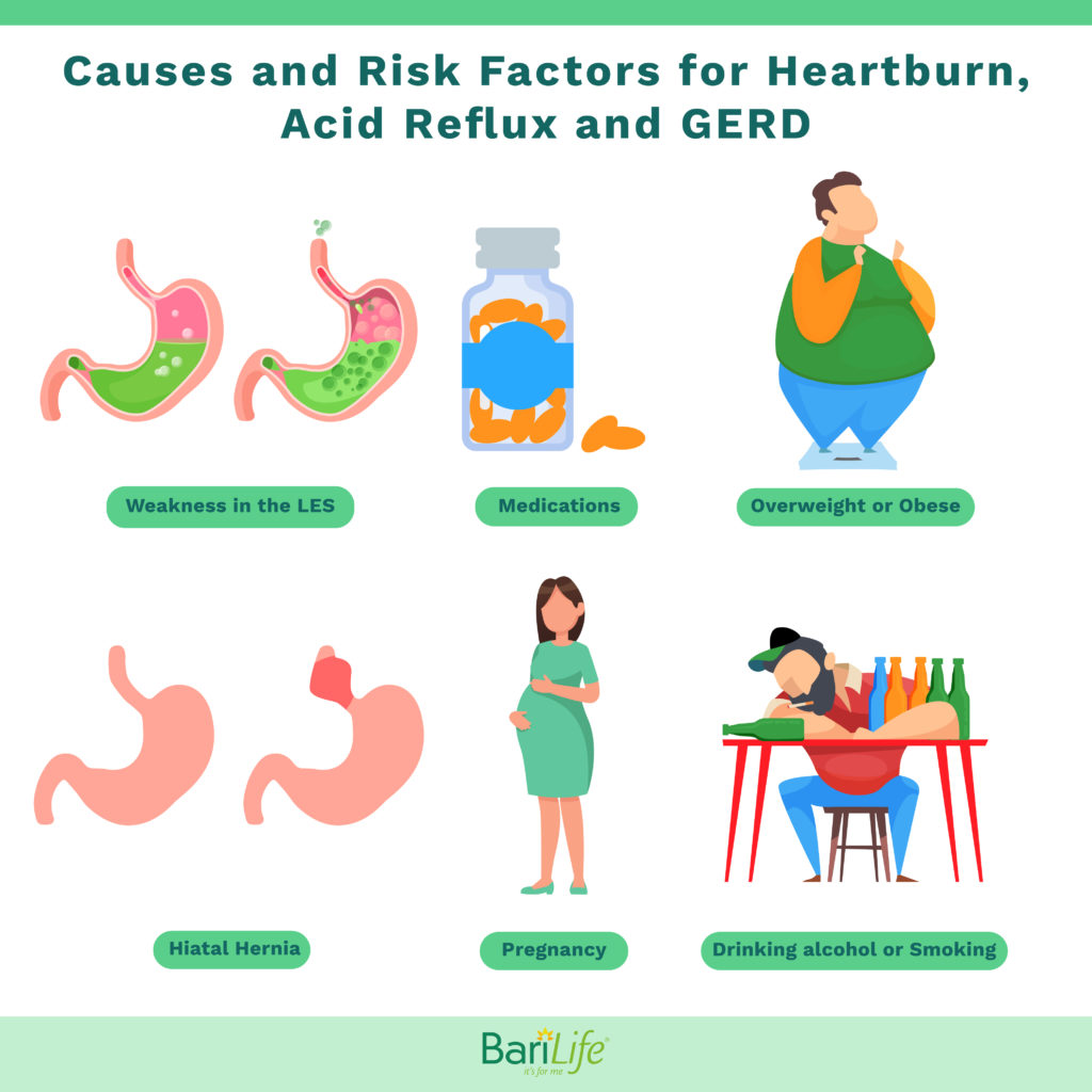 Risk factors for Acid Reflux GERD and Heartburn