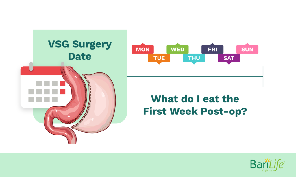 Eating One Week After Gastric Sleeve Bari Life