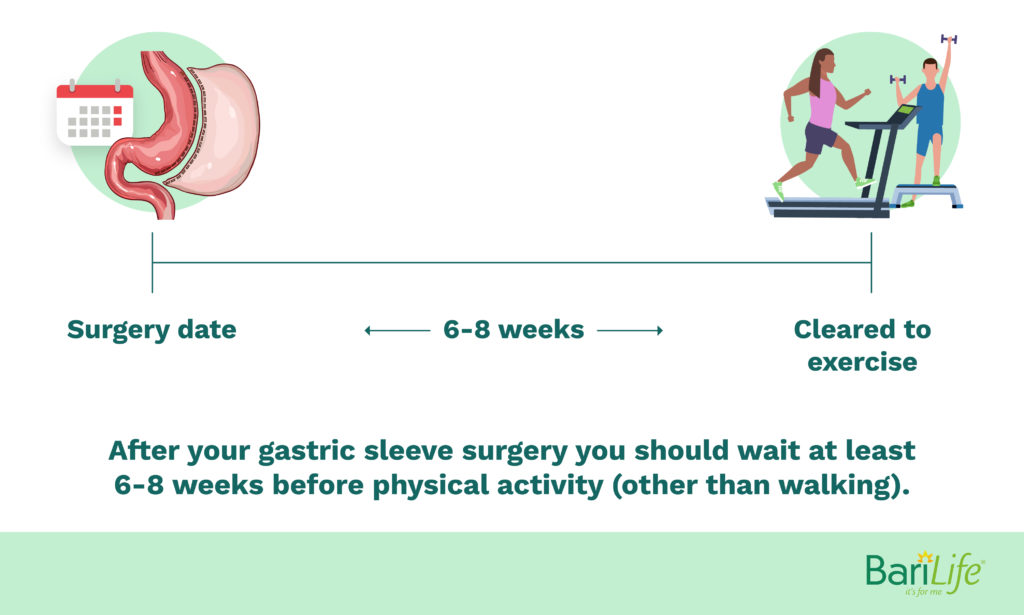 Wait 6 to 8 weeks before exercising after gastric sleeve surgery