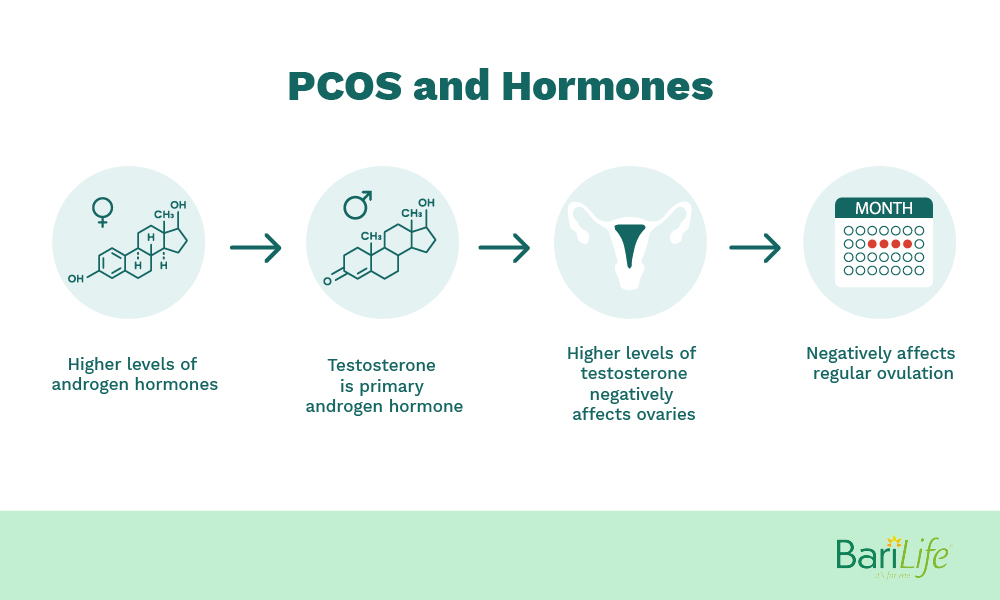 PCOS and hormones after gastric sleeve