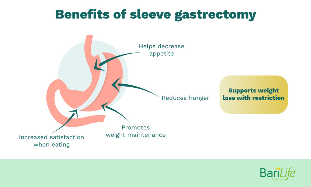 Why Am I Not Losing Weight After Gastric Sleeve Surgery? 7 Reasons Why Bari Life