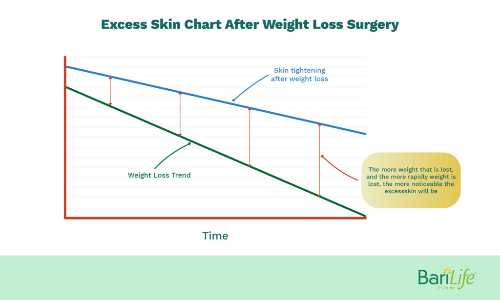 The greater the weight loss after bariatric surgery generally results in more excess skin.