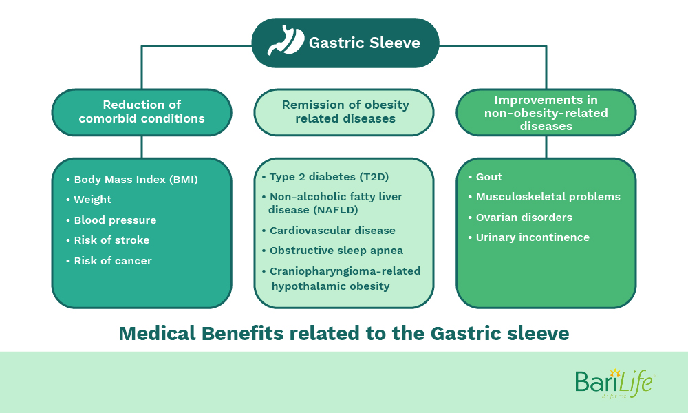 Benefits of gastric sleeve surgery
