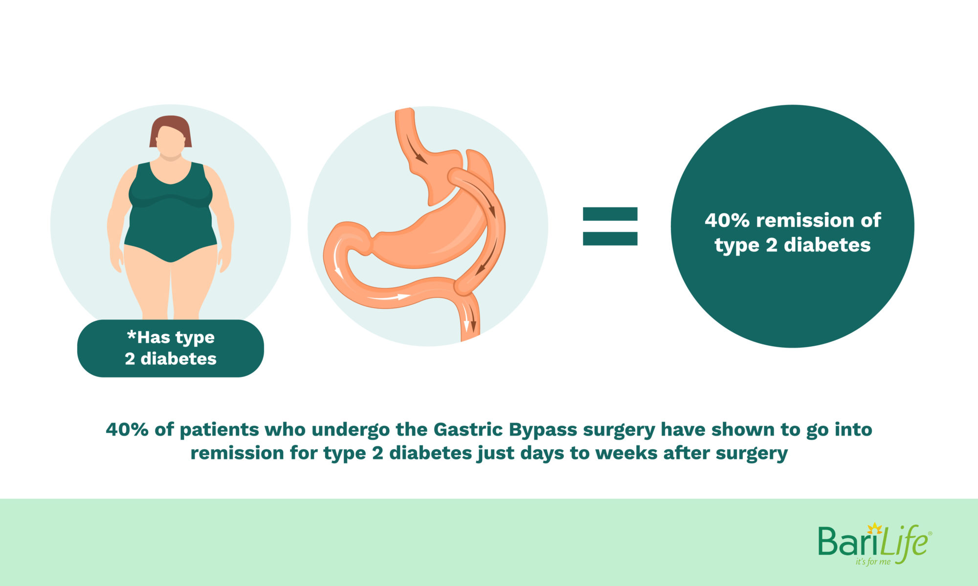 Pros and Cons of Gastric Bypass Surgery Barilife Educational Blogs