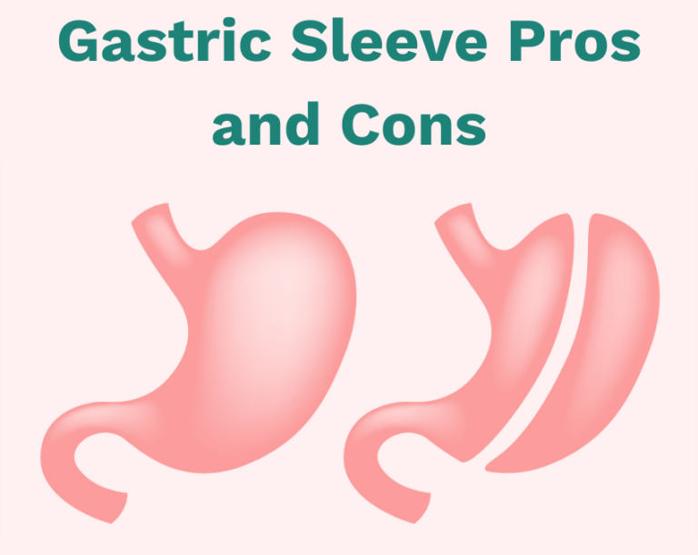 Gastric Sleeve Pros and Cons