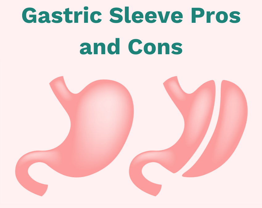 Gastric Sleeve Pros and Cons feature