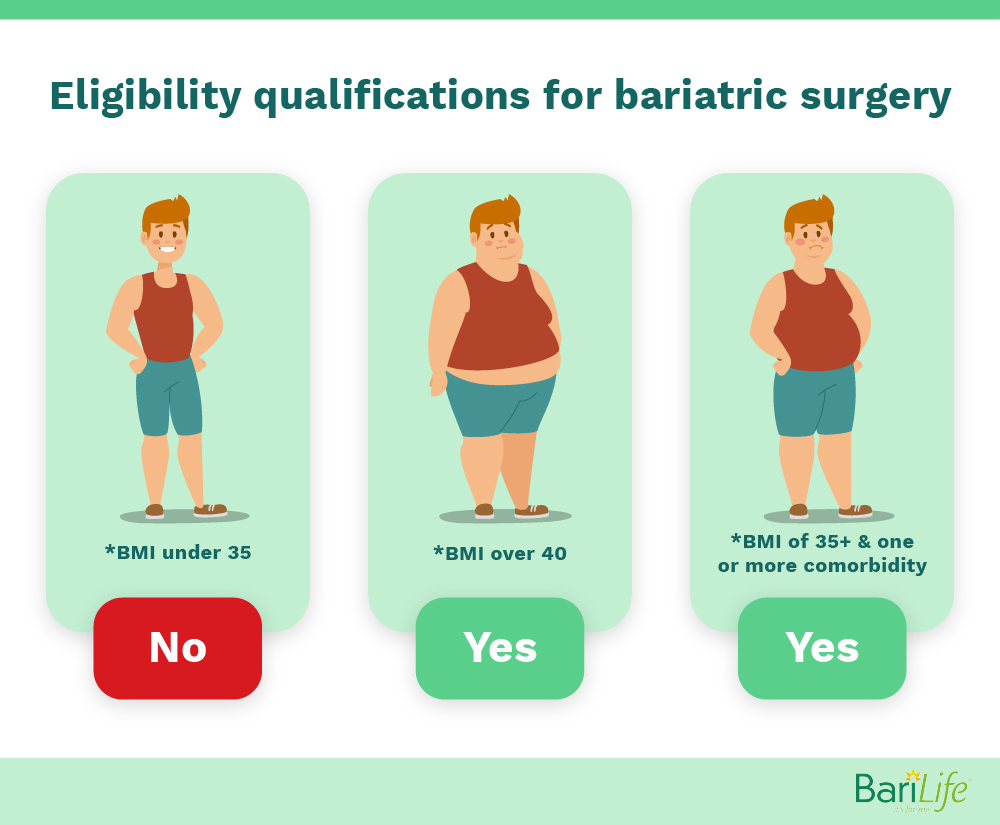 Mini-Gastric Bypass vs. RNY Gastric Bypass Bari Life