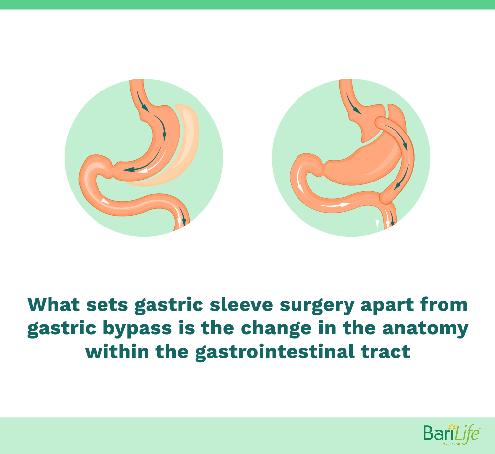 Difference between gastric sleeve and gastric bypass