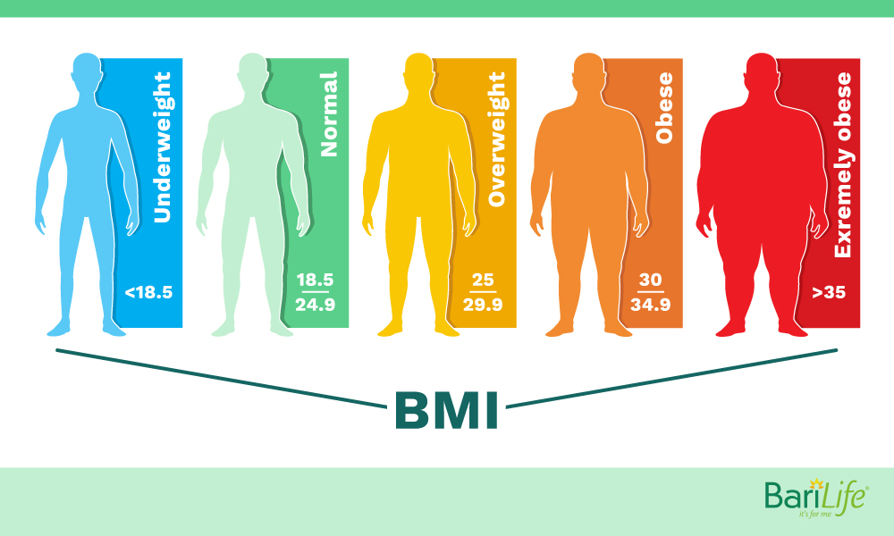 BMI qualification for gastric sleeve