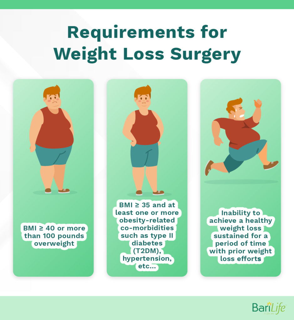 Gastric Sleeve vs. Lap Band Bari Life