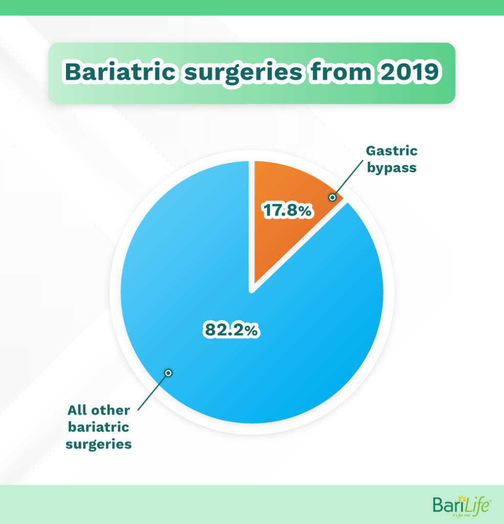 How Much Do You Have to Weigh To Have Gastric Bypass Surgery Bari Life