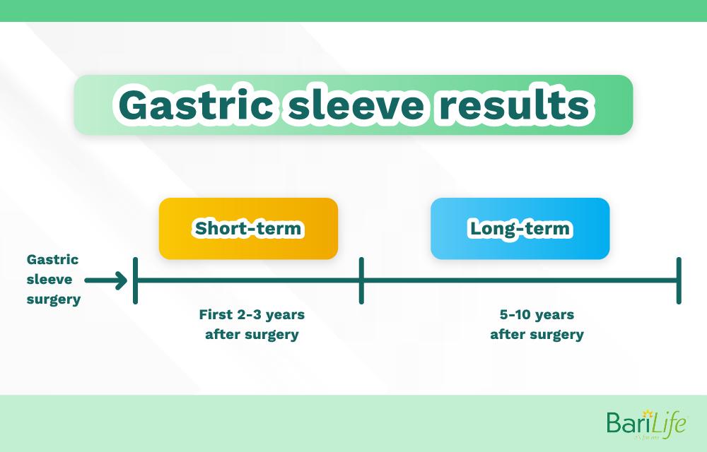 Getting the Most Out of Your Gastric Sleeve Results Bari Life
