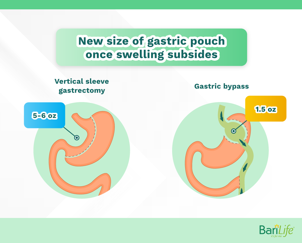 Pouch size changes a small amount