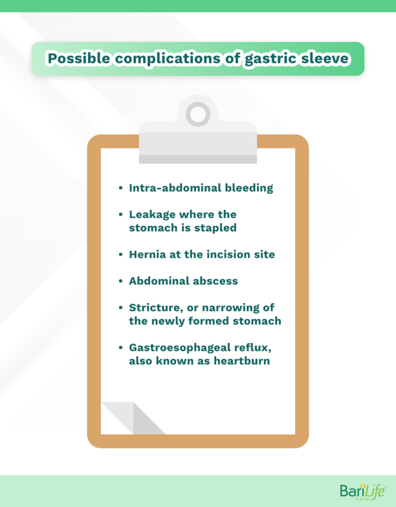 Gastric sleeve complications