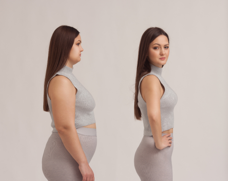 Average Weight Loss After Bariatric Surgery: What to Expect
