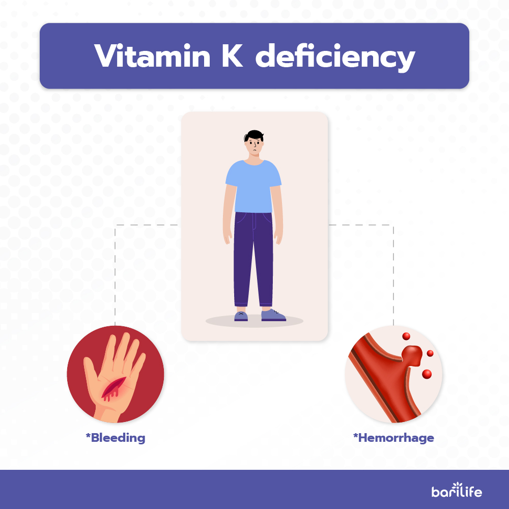 Vitamin K Deficiency signs