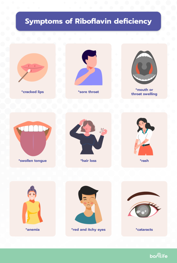 symptoms of riboflavin deficiency