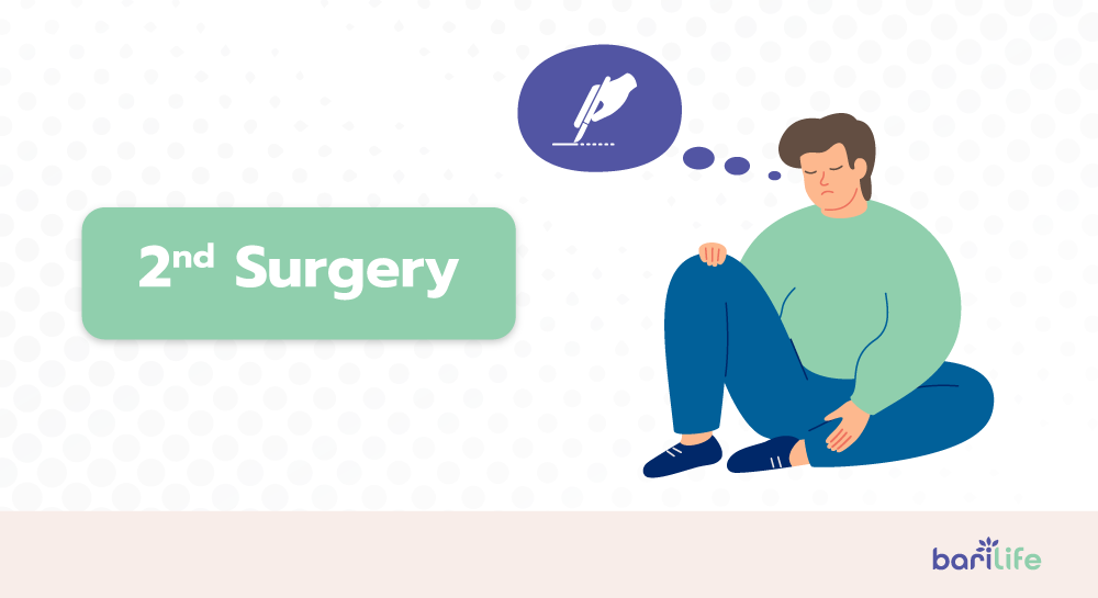 Considering revision surgery after gastric sleeve