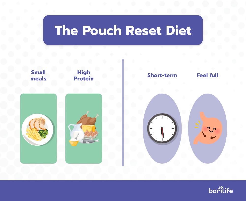 How to overcome your weight loss plateau after gastric sleeve surgery Bari Life How to overcome your weight loss plateau after gastric sleeve surgery Bari Life
