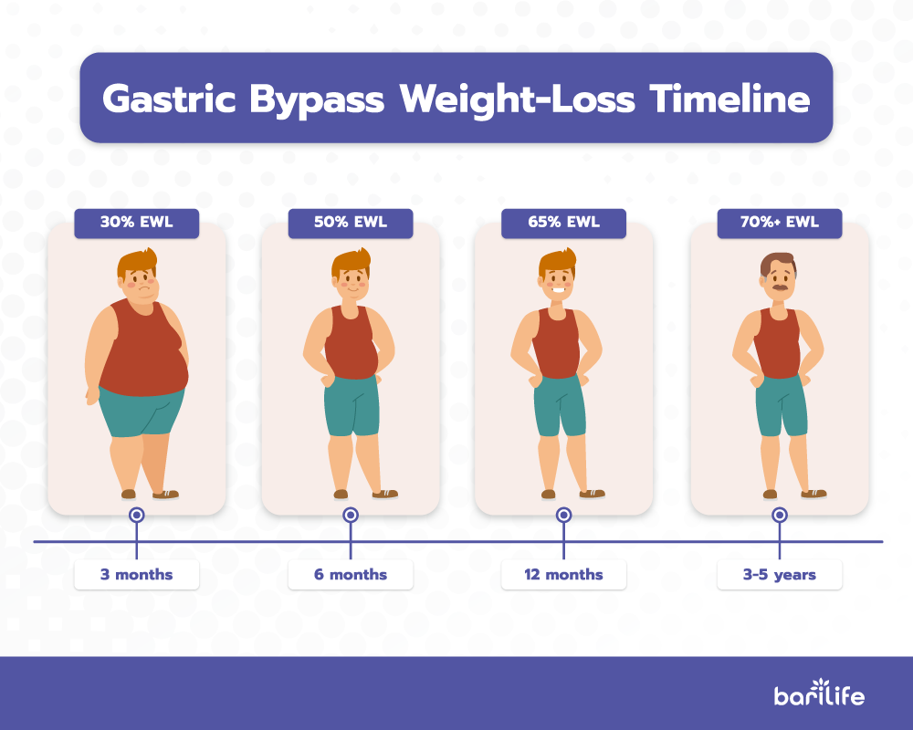 Gastric Bypass Weight Loss Timeline