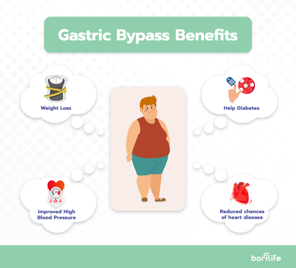 Gastric Bypass Weight Loss Chart Bari Life