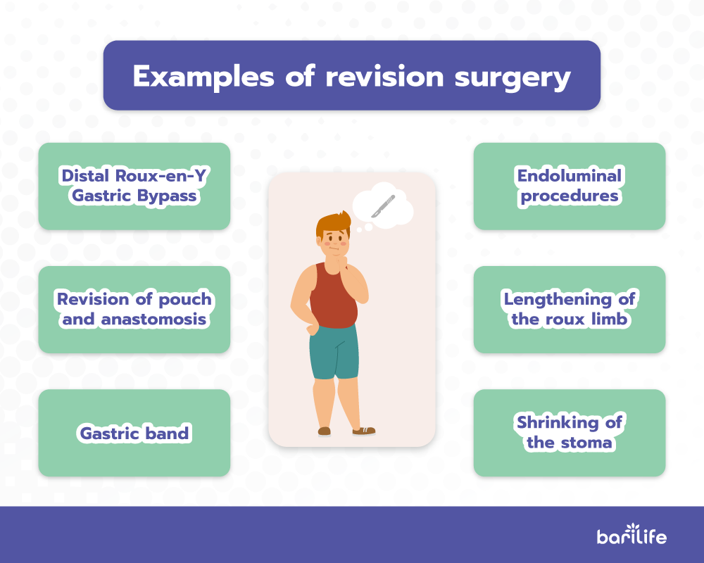 Gastric Bypass Revision Bari Life