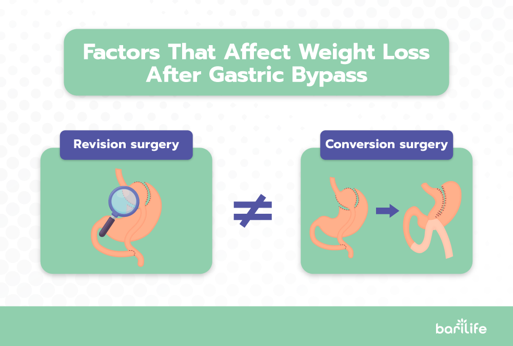 Gastric Bypass Revision Bari Life