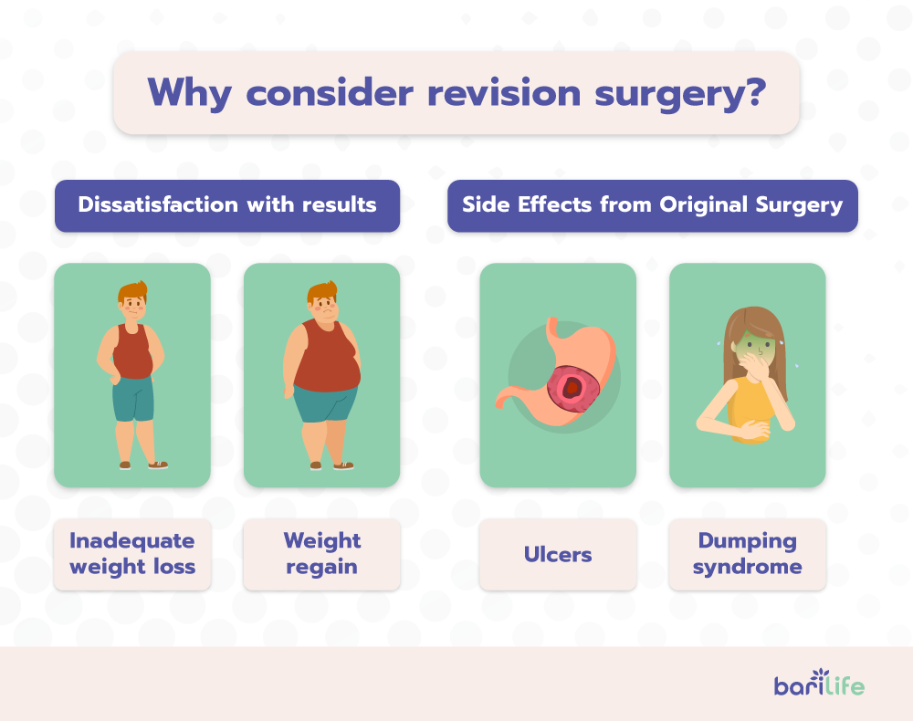 Gastric Bypass Revision Bari Life