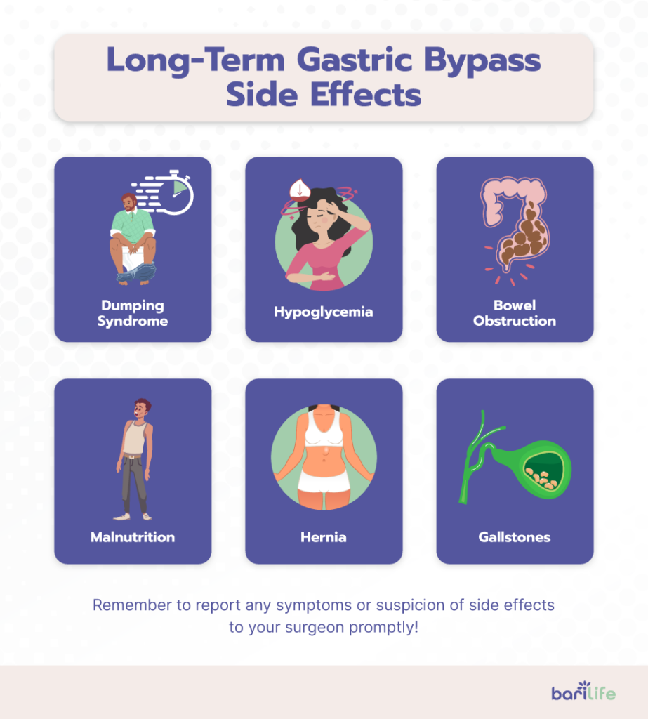 Your Expected Gastric Bypass Surgery Recovery Timeline Bari Life