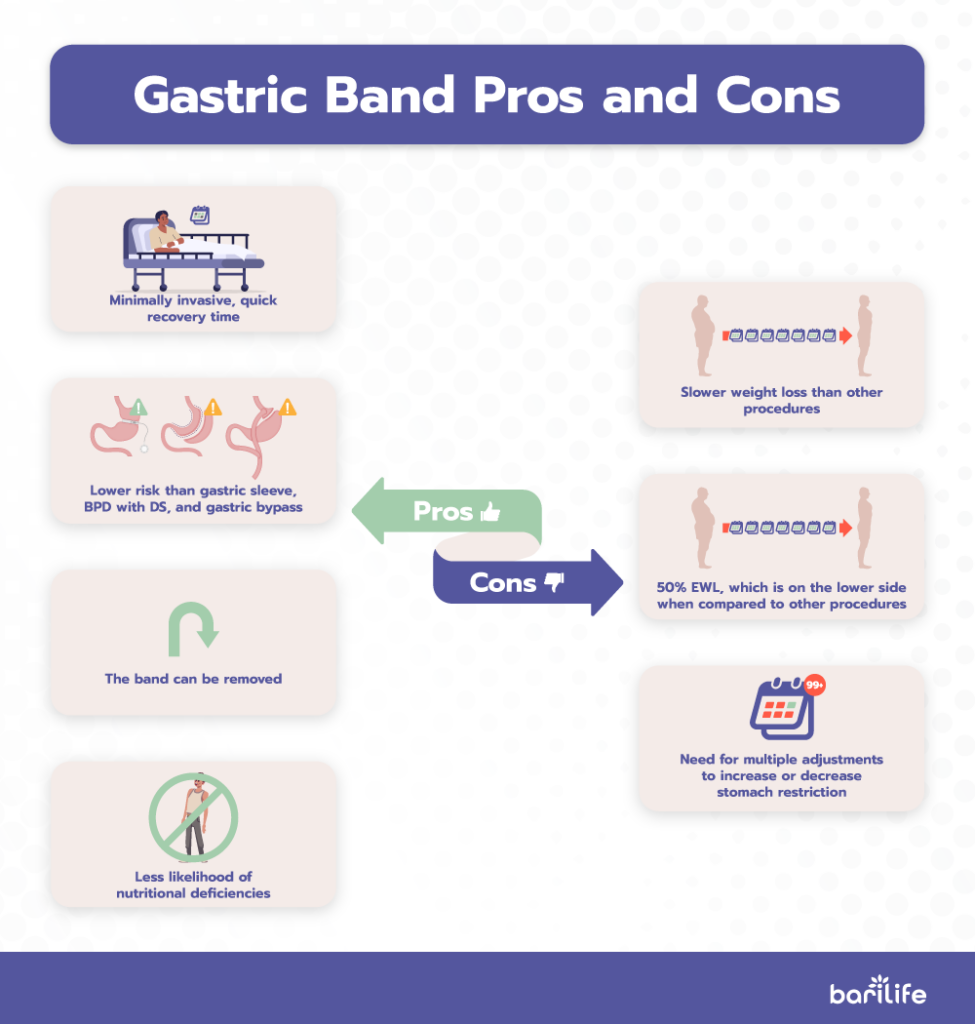 Gastric Banding pros and cons list