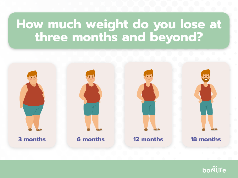 Gastric Sleeve Results After One Month Bari Life