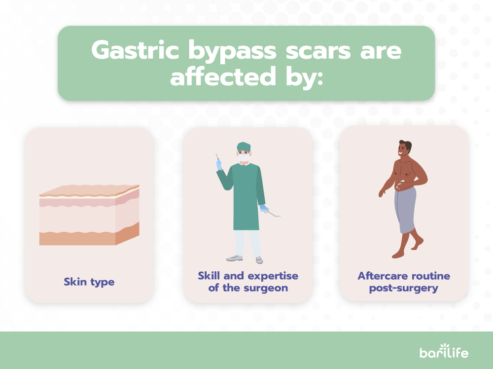Gastric Bypass Incisions Bari Life