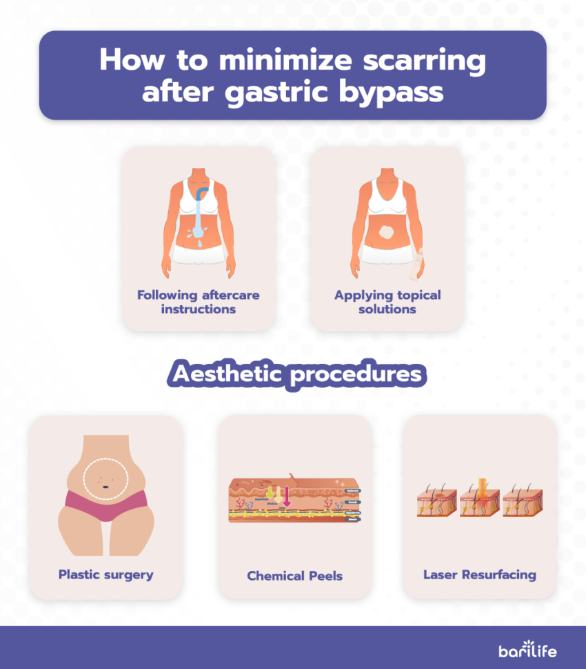 Gastric Bypass Incisions Everything You Need To Know gastric-bypass-incisions-everything-you-need-to-know