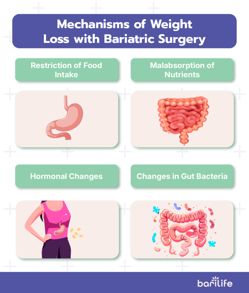 bariatric surgeries