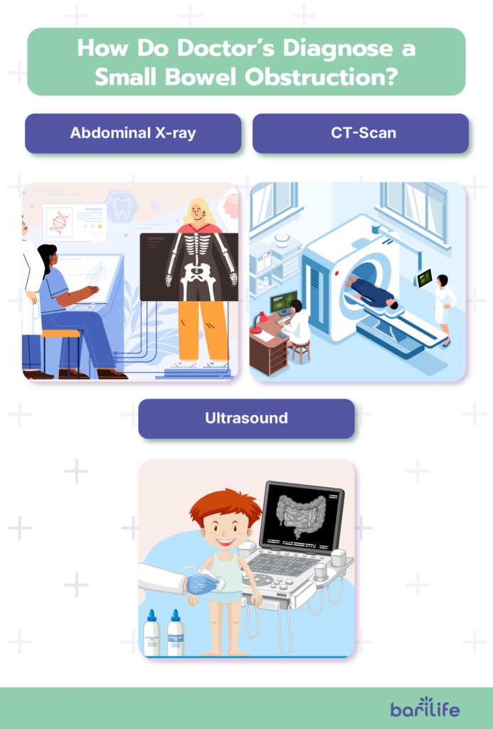 small bowel obstruction bariatric surgery
