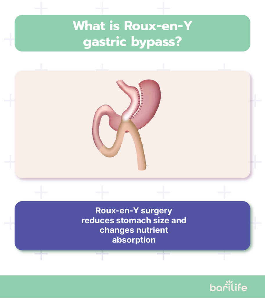 roux en y bariatric surgery