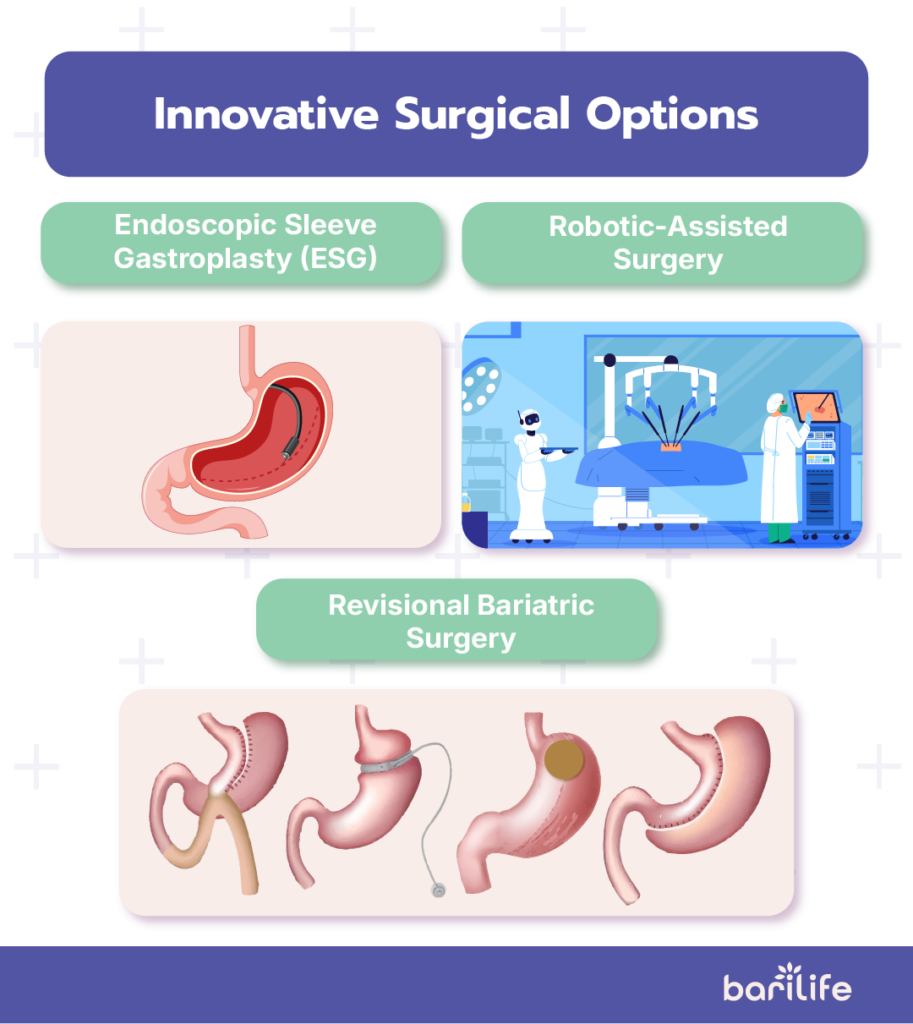 latest bariatric procedures
