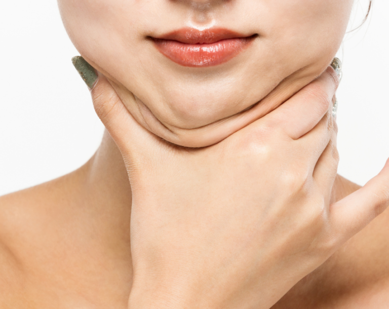 How to Avoid Sagging Skin After Bariatric Surgery – Explanation and Tips