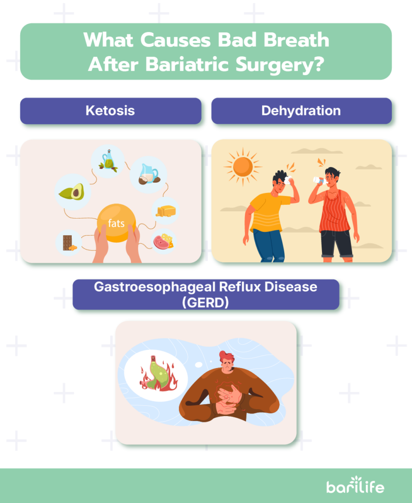 bad breath after bariatric surgery