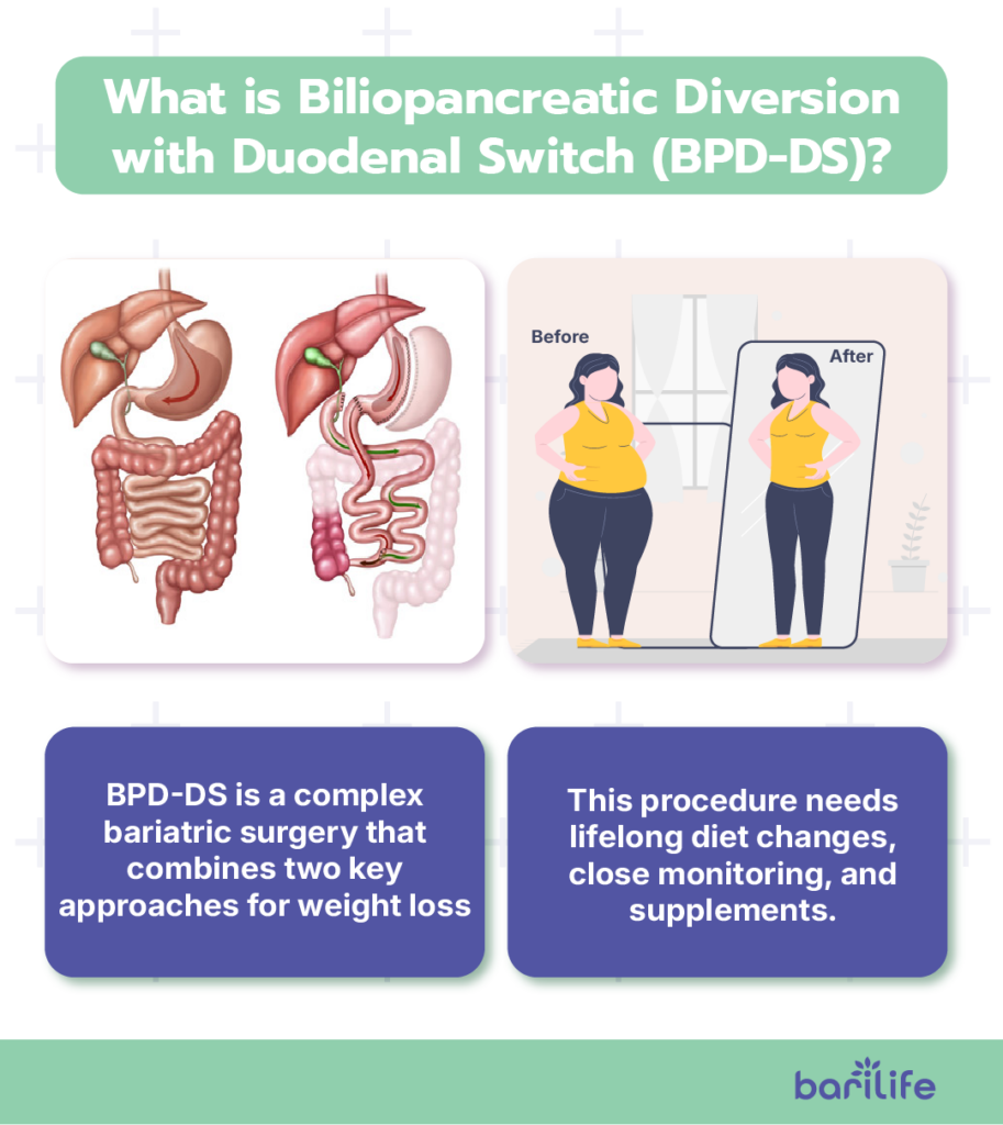 bpd bariatric surgery