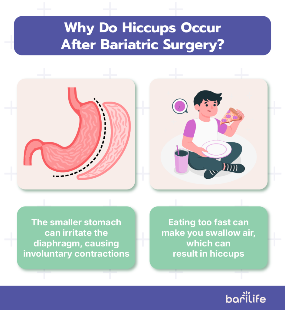 hiccups after bariatric surgery