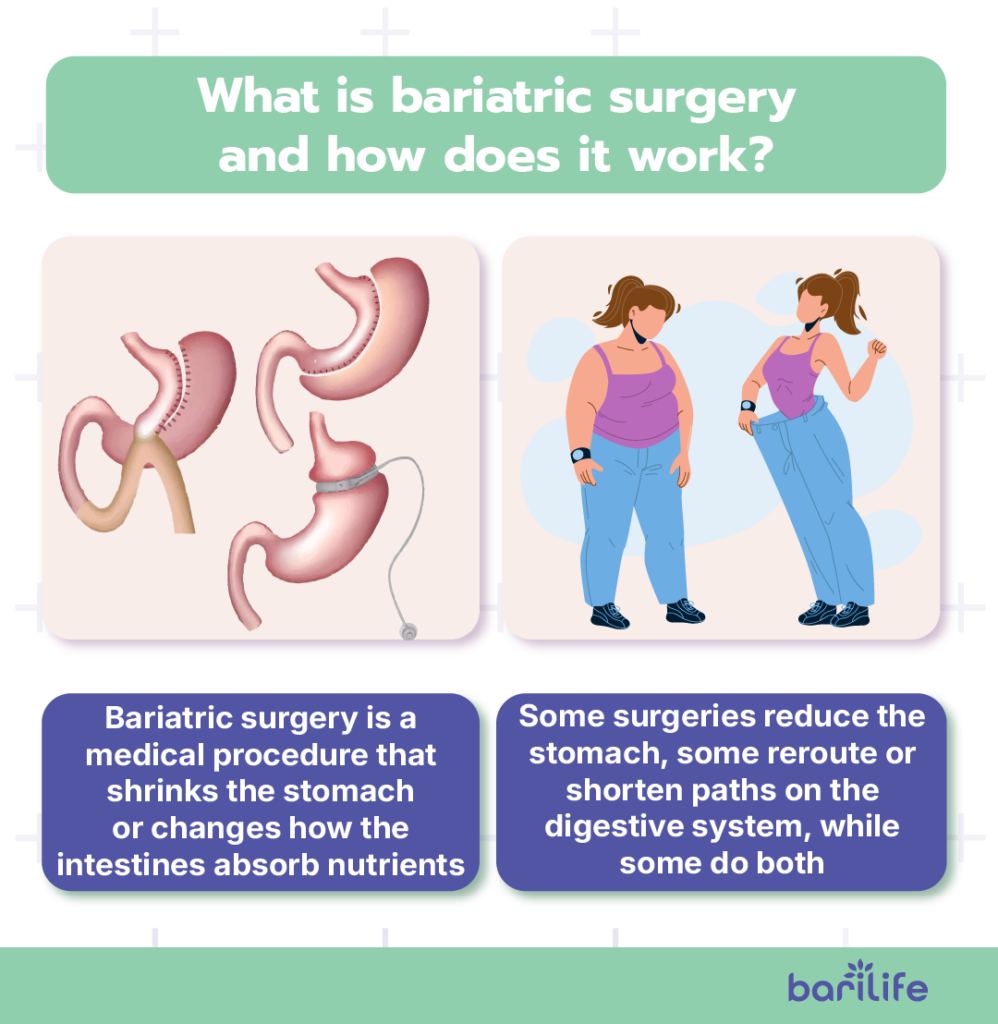 how does bariatric surgery work
