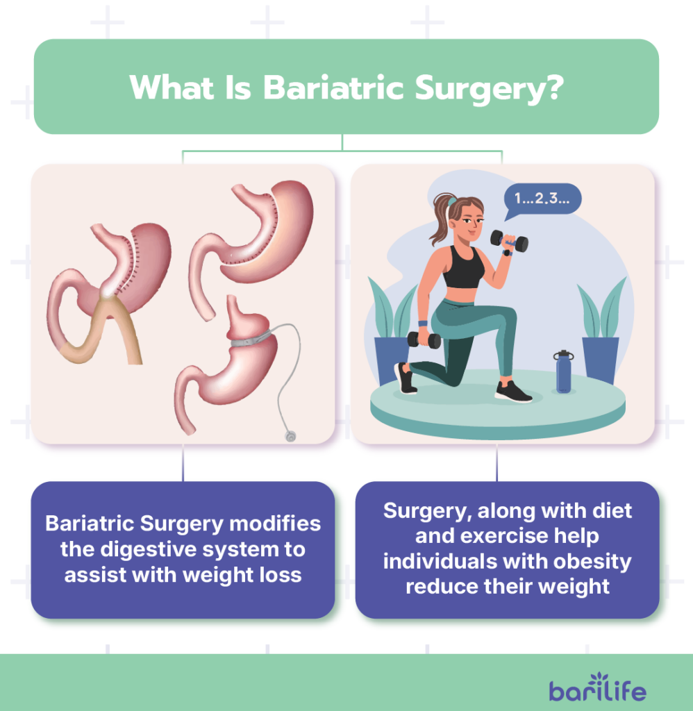 how long does bariatric surgery take