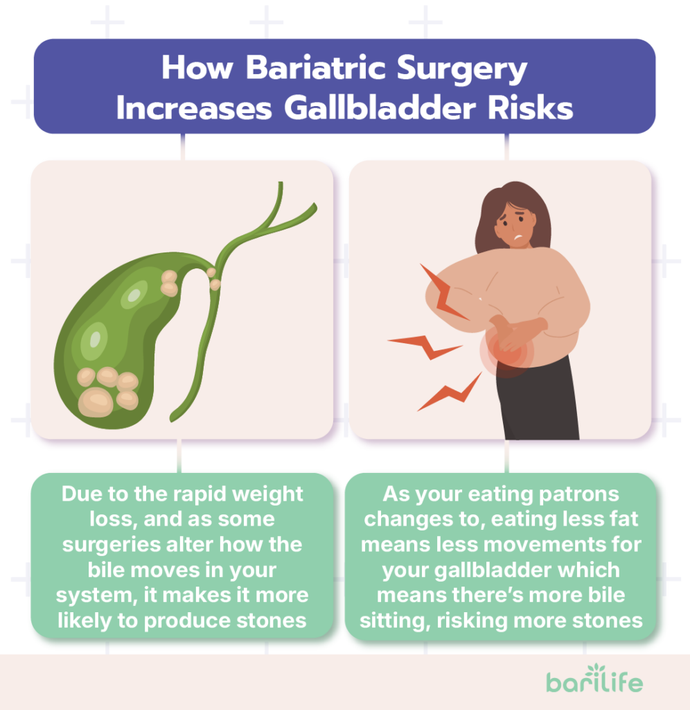 gallbladder pain after bariatric surgery
