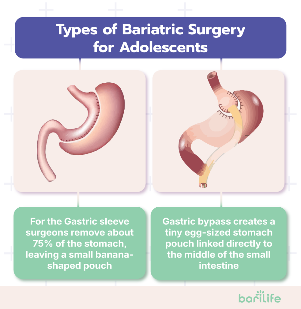 bariatric surgery teens